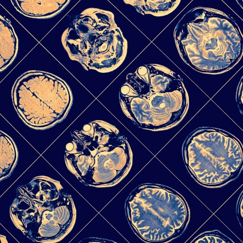 MRI scan, close-up
