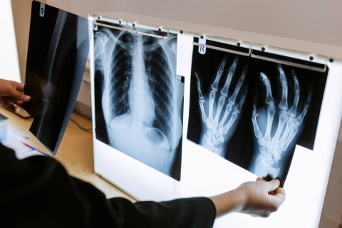 X-ray chart