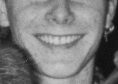 a black and white image of a persons smile with teeth showing. The photo shows the face from the nose under to the chin up.